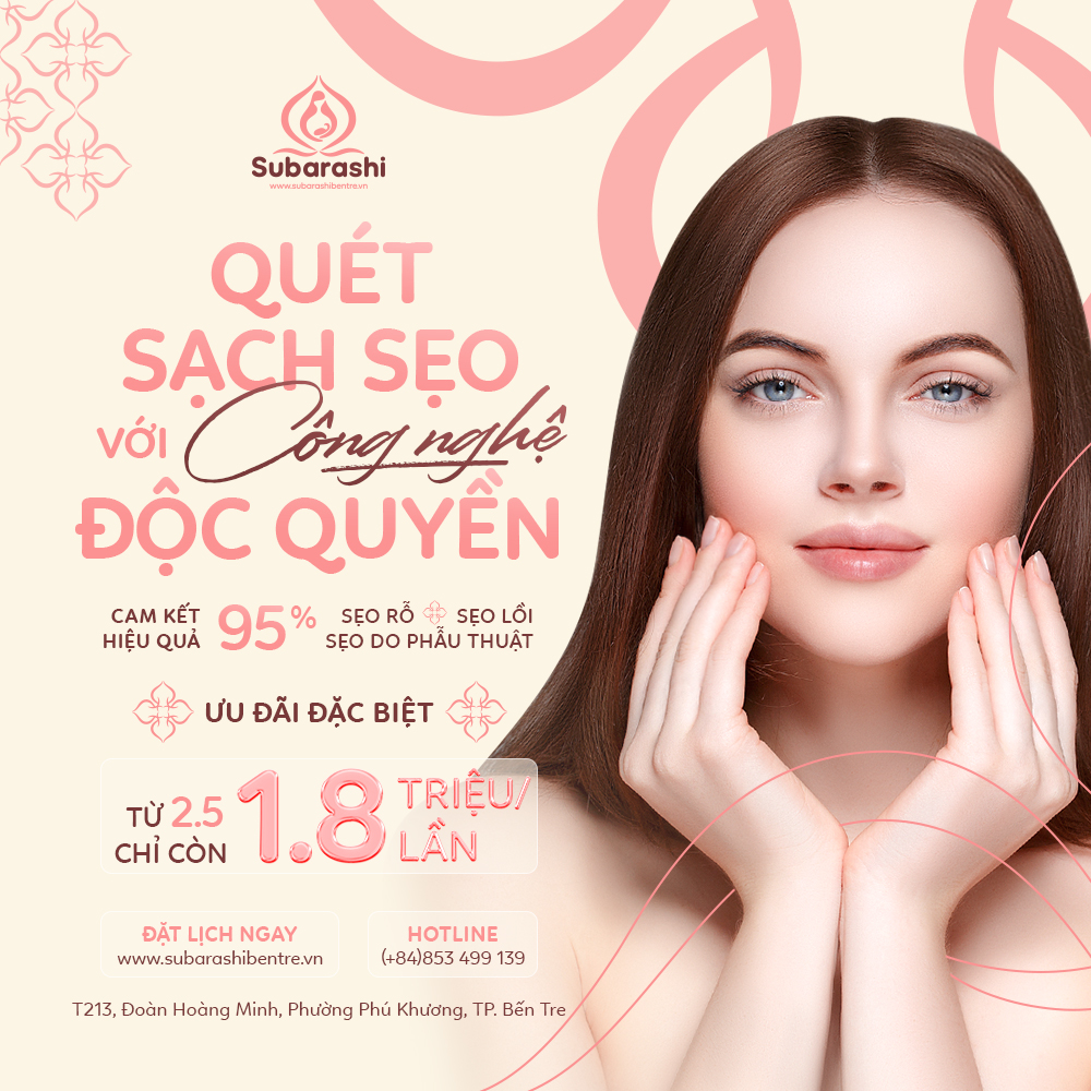 Subarashi_QuetSachSeo_Popup